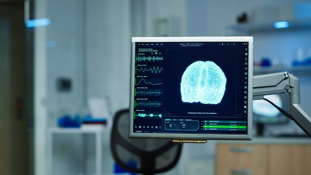 el electroencefalograma (EEG) para medir la actividad cerebral mientras las personas veían anuncios